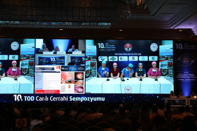 Göz Hekimleri Canlı Yayında  4 Günde 70 Ameliyat Yapacak